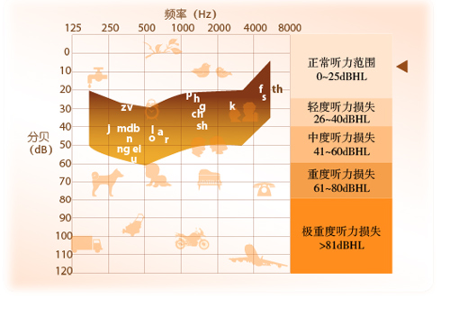 轻度听力损失 听力损失的分类